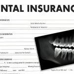 Costco Dental Insurance provides affordable, quality coverage for routine care and major procedures, ensuring dental wellness for all