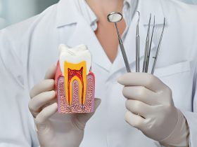 Are Dental Implants Covered by Insurance