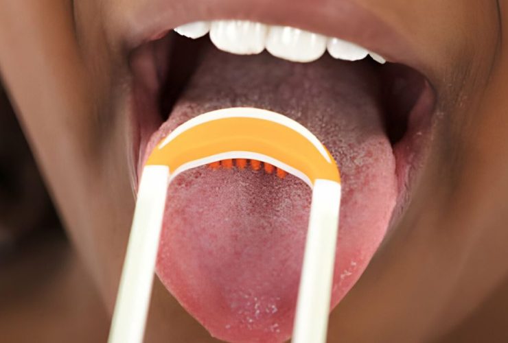 Tongue Brush
