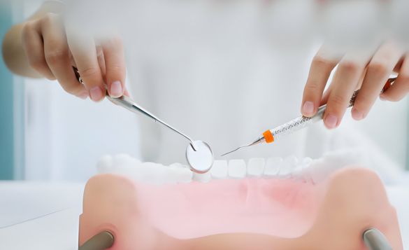 How to Take Care of a Front Tooth Crown