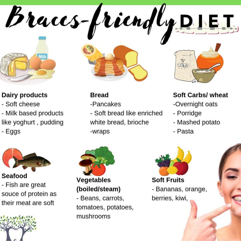 Soft Foods for Braces